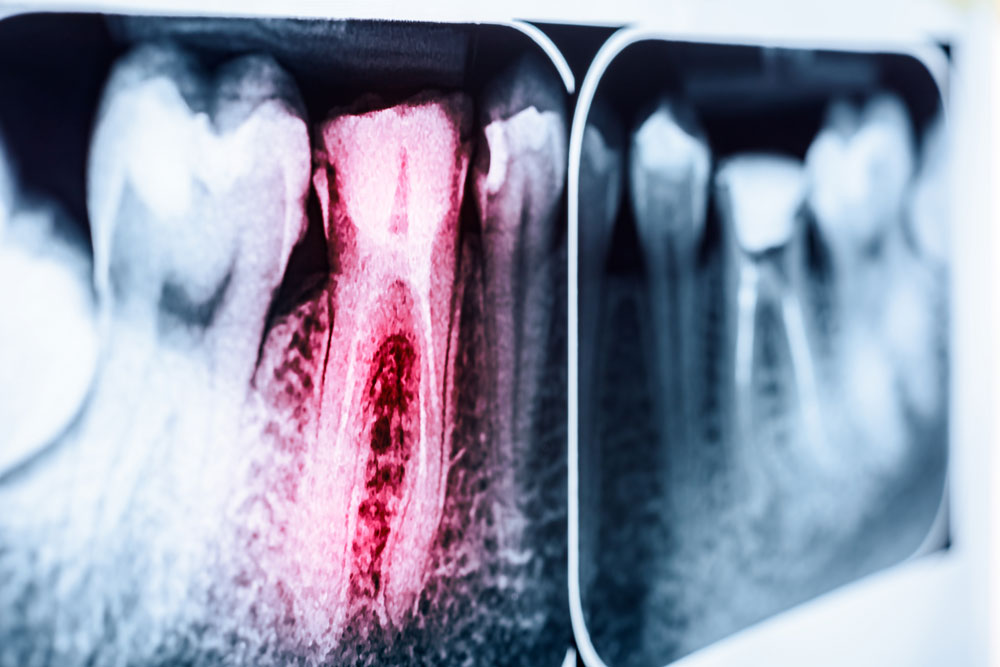 clínica dental en Tomares, dentista en Tomares, cirugía bucal en Tomares, exodoncia en Tomares, gingivectomía en Tomares, extracción de cordales de Tomares