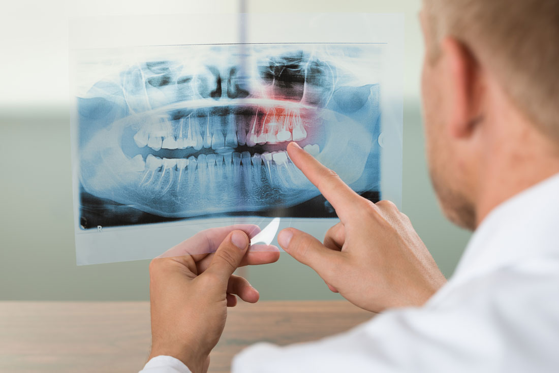 Endodoncia