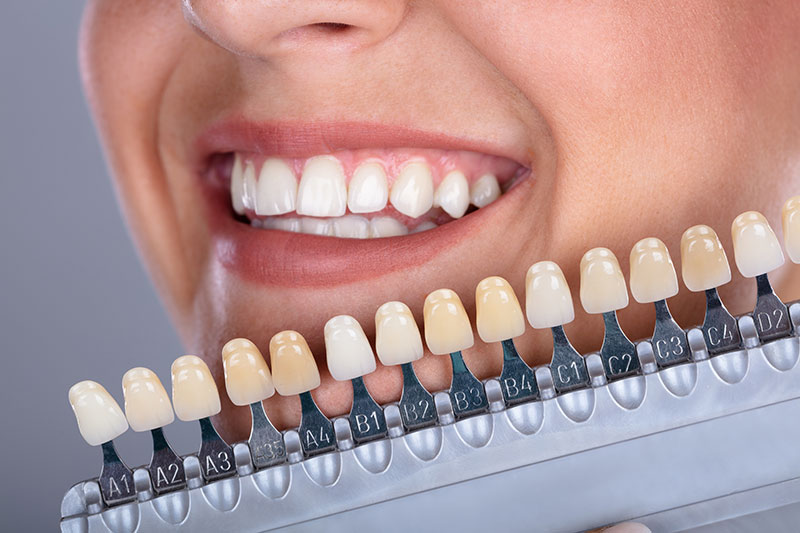 polident_sevilla-tratamientos-estetica-dental-carillas clínica dental en Tomares, dentista en Tomares, estética dental en Tomares, blanqueamiento dental en Tomares, carillas dentales en Tomares, diseño de sonrisa en Tomares.