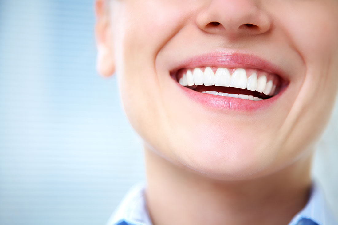Estética dental