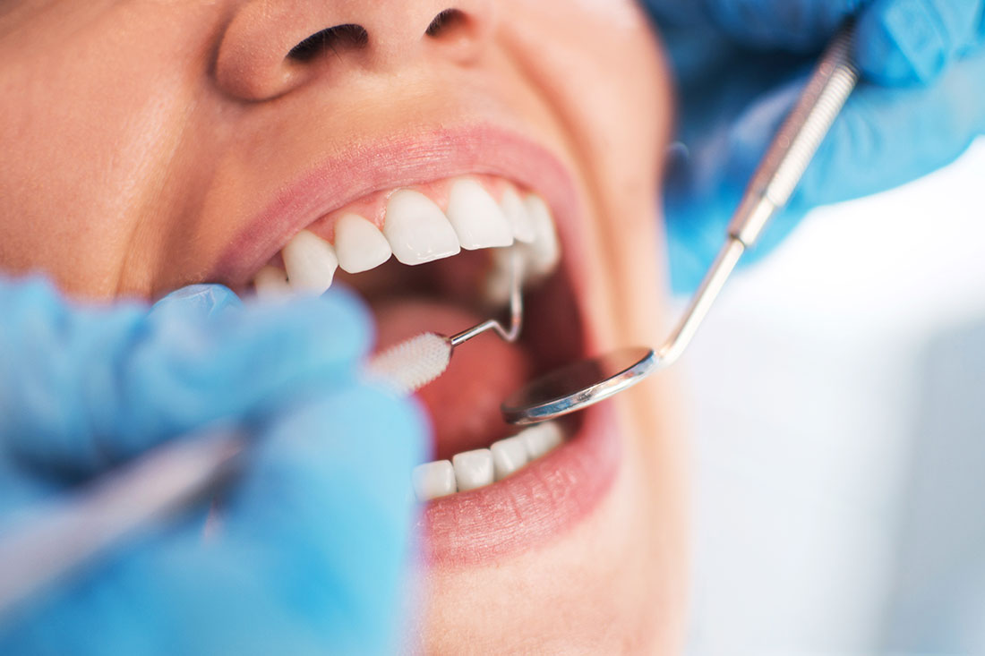 Periodoncia