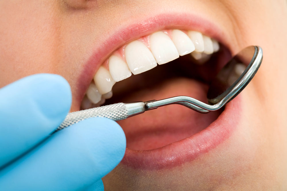 polident_sevilla-tratamientos-periodoncia2 clínica dental en Tomares, dentista en Tomares, periodoncia en Tomares, profilaxis dental en Tomares, curetaje en Tomares, gingivectomía en Tomares, cirugía bucodental en Tomares