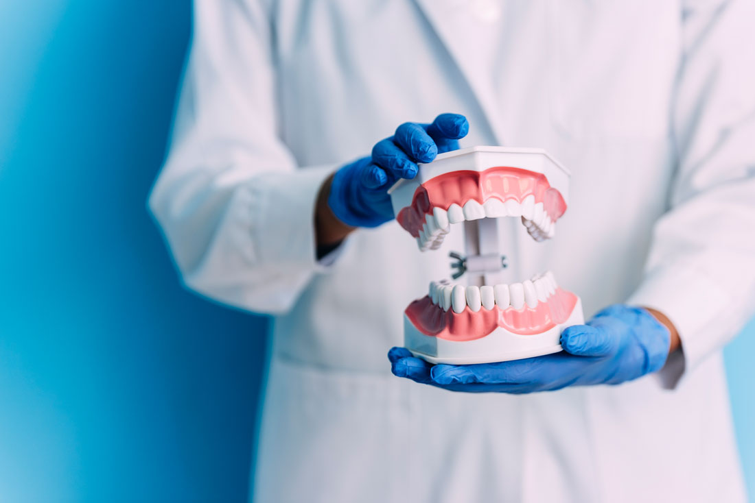 Prótesis dentales