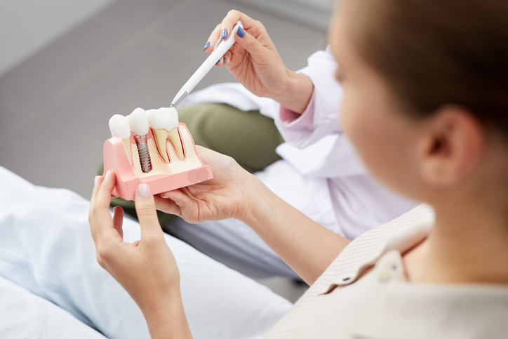 Dientes perdidos: ¿por qué debes reponerlos con implantes dentales?