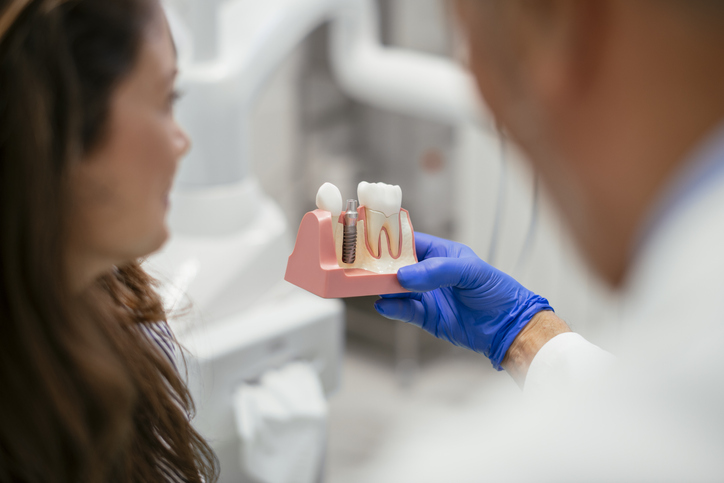 ¿Cuántos años duran los implantes dentales?